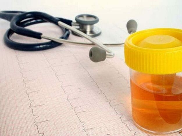 analýza moču na diagnostiku cystitídy